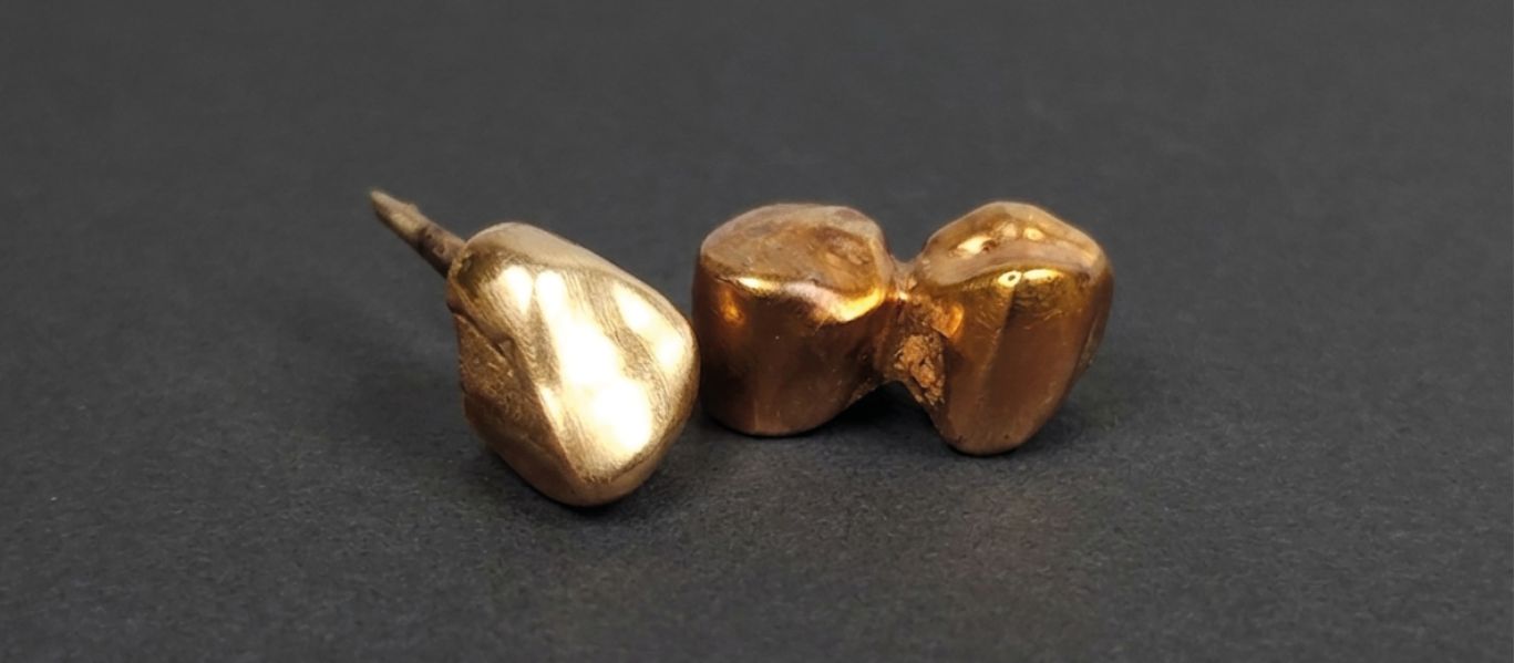 guldpris-tandguld-1367x599_01.jpg